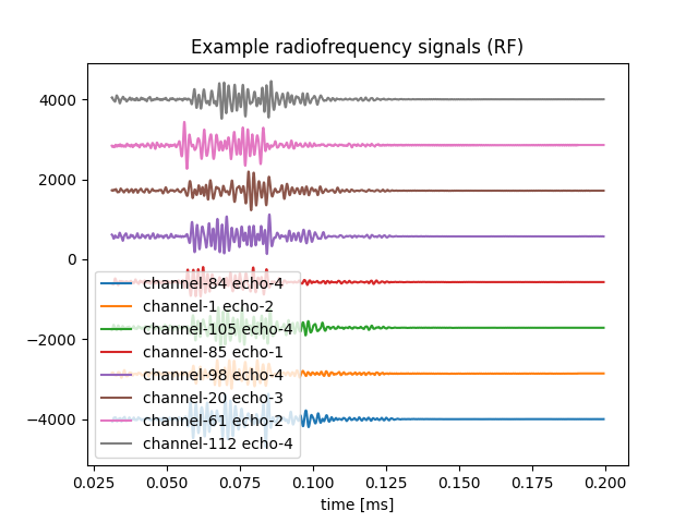 Example radiofrequency signals (RF)